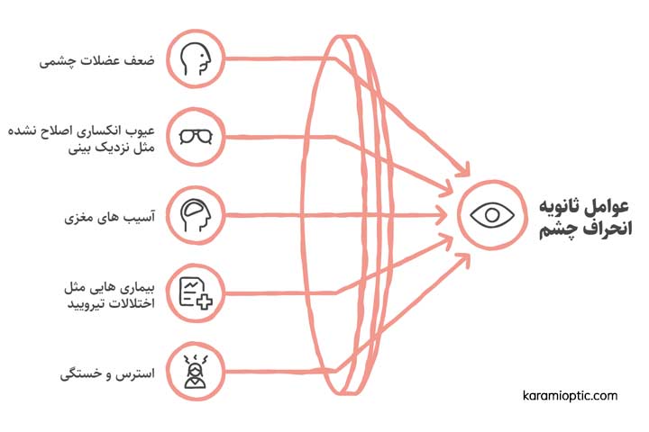 عوامل محیطی انحراف چشم