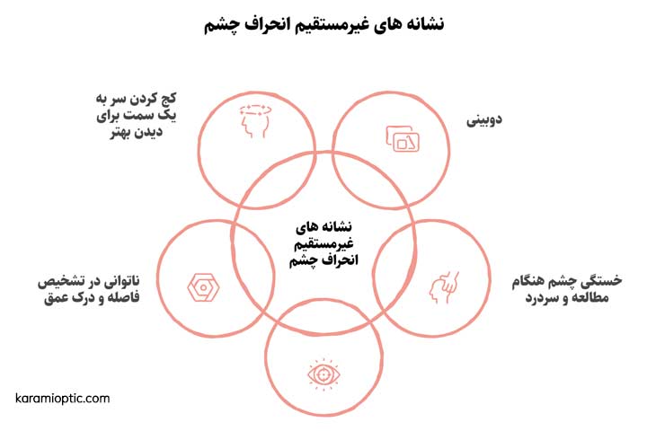 علائم انحراف چشم
